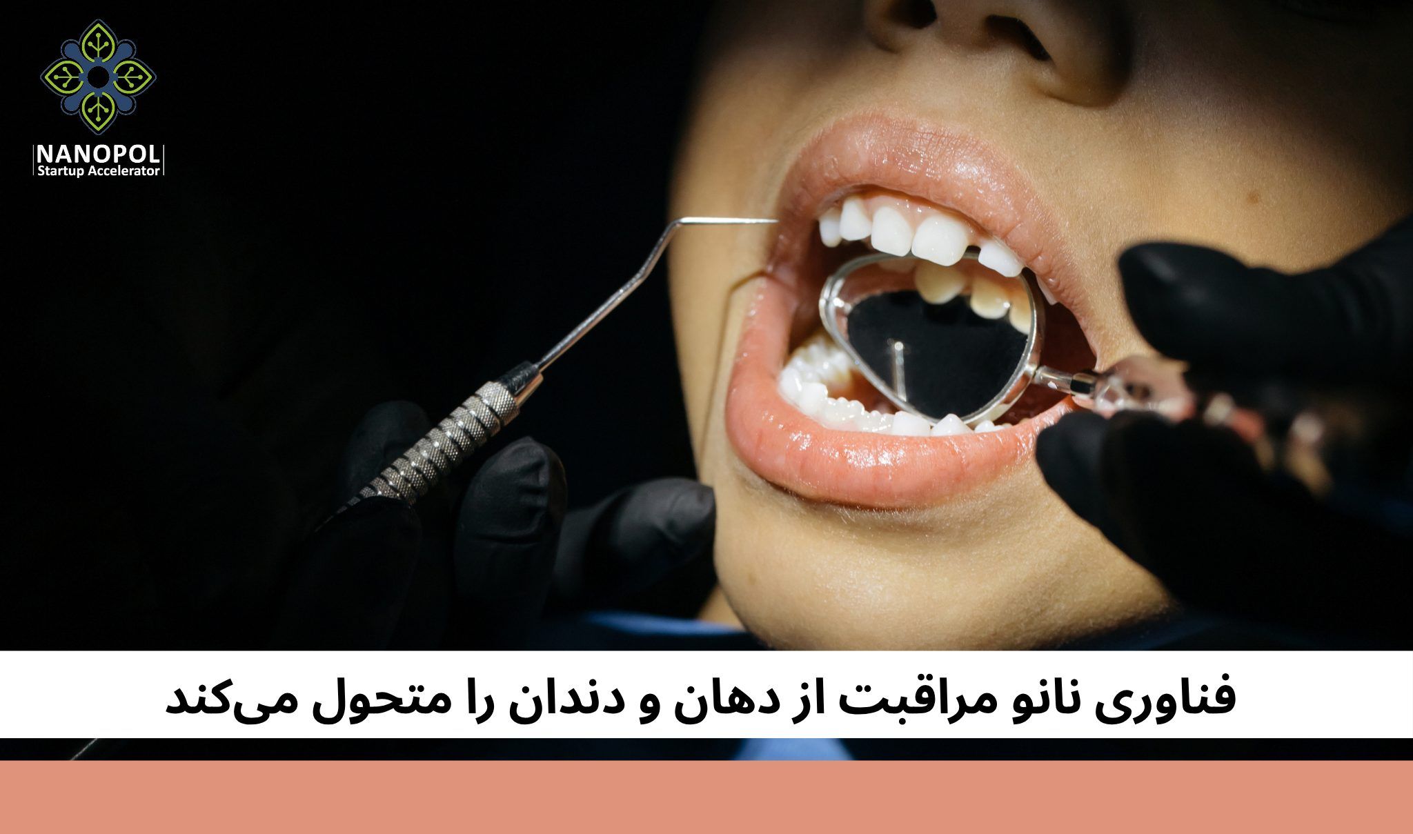 فناوری نانو، مراقبت از دهان و دندان را متحول می‌کند 