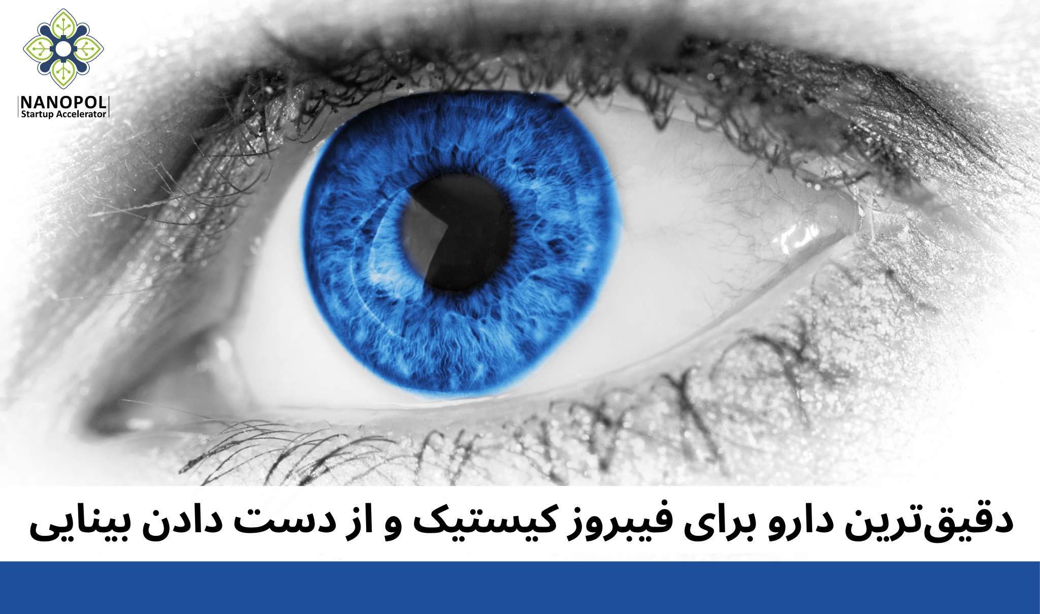 دقیقترین دارو برای فیبروز کیستیک و از دست دادن بینایی