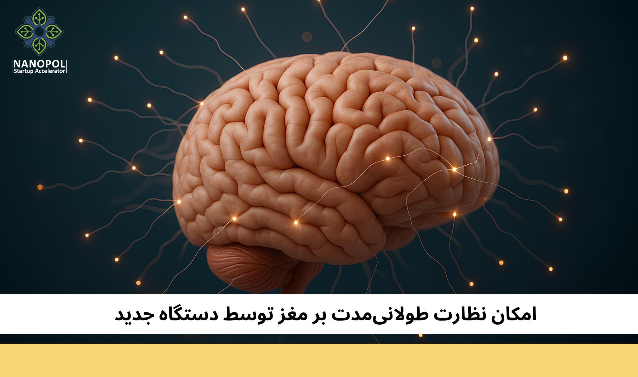 دستگاه انعطاف‌پذیر جدید، امکان نظارت طولانی‌مدت بر مغز را فراهم می‌کند